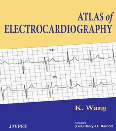 Atlas of Electrocardiography